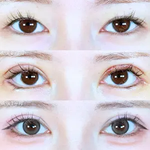 アリエル美容クリニック 大宮院 江郷隼一郎医師の症例