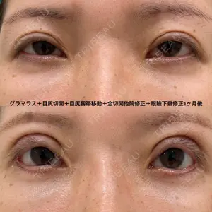 エターナル美容クリニック 久門田 詳医師の症例