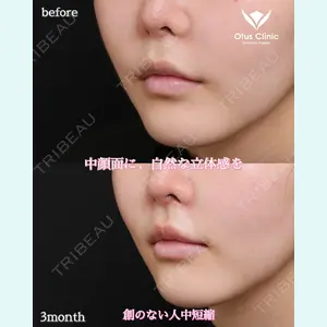 Otus Clinic 【オータスクリニック】 中 徳太郎医師の症例