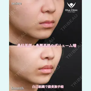 Otus Clinic 【オータスクリニック】 中 徳太郎医師の症例