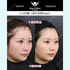 Otus Clinic 【オータスクリニック】 中 徳太郎医師の症例