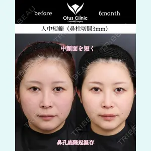 Otus Clinic 【オータスクリニック】 中 徳太郎医師の症例