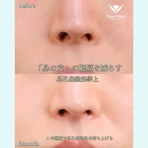 Otus Clinic 【オータスクリニック】 中 徳太郎医師の症例