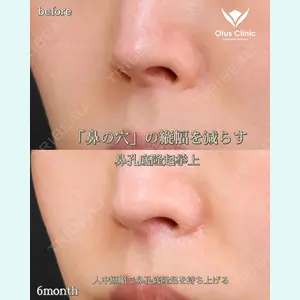 Otus Clinic 【オータスクリニック】 中 徳太郎医師の症例