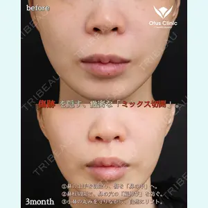 Otus Clinic 【オータスクリニック】 中 徳太郎医師の症例