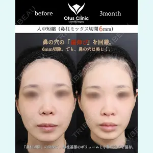 Otus Clinic 【オータスクリニック】 中 徳太郎医師の症例