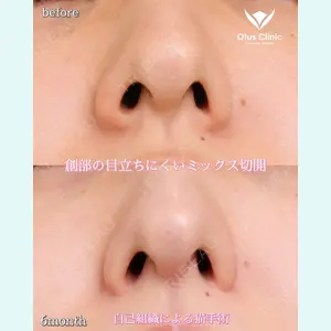 Otus Clinic 【オータスクリニック】 中 徳太郎医師の症例