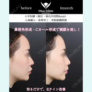 Otus Clinic 【オータスクリニック】 中 徳太郎医師の症例