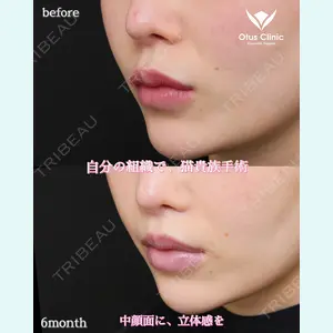 Otus Clinic 【オータスクリニック】 中 徳太郎医師の症例