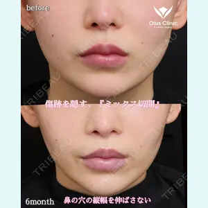 Otus Clinic 【オータスクリニック】 中 徳太郎医師の症例