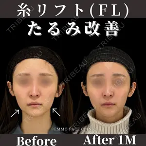 EMMO FACE CLINIC 東京三田院 木之下 哲彦医師の症例