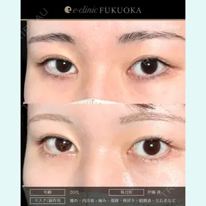 eクリニック 福岡院 伊藤 渉医師の症例