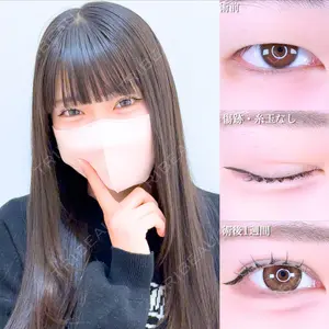 アリエル美容クリニック 水戸院 天白 典秀医師の症例