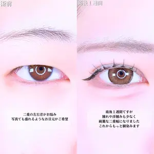 アリエル美容クリニック 水戸院 天白 典秀医師の症例