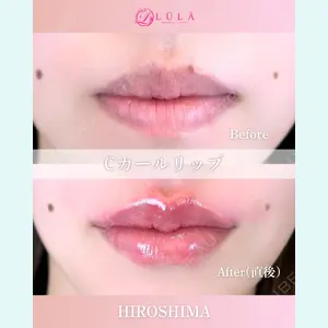 ルラ美容クリニック 広島院の症例