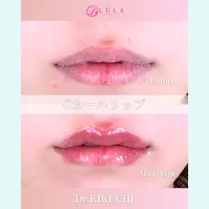 ルラ美容クリニック 広島院 角南 亮輔医師の症例