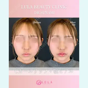 ルラ美容クリニック 広島院の症例
