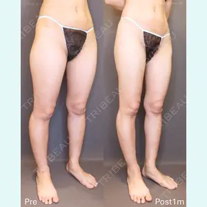 FIG CLINIC 喜多村 勇大朗医師の症例