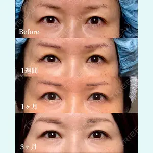 池袋麗歯科・美容皮膚科 夏目 隆太郎医師の症例