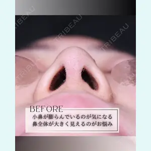 小倉美容外科/美容皮膚科 ビラビューティークリニック 大村 亞蘭医師の症例