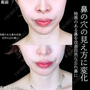 アリエル美容クリニック 大宮院 阪野 一世医師の症例