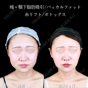 アリエル美容クリニック 大宮院 鈴木　桂介医師の症例