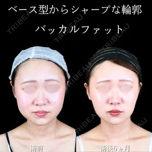 アリエル美容クリニック 大宮院 鈴木　桂介医師の症例