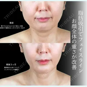 アリエル美容クリニック 横浜院 渡邉 光医師の症例