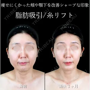 アリエル美容クリニック 横浜院 渡邉 光医師の症例