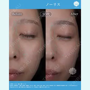 LA MER CLINICの症例