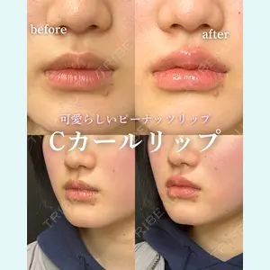 ルラ美容クリニック 岐阜院 馬場 愛理医師の症例