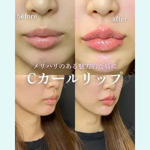 ルラ美容クリニック 岐阜院 馬場 愛理医師の症例