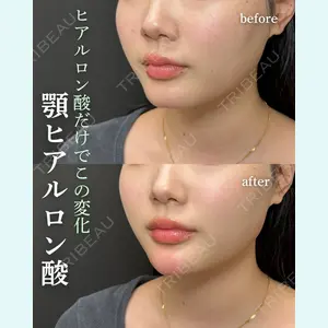 ルラ美容クリニック 岐阜院 馬場 愛理医師の症例