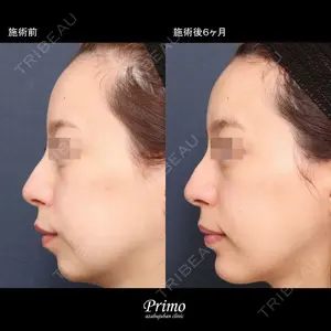 プリモ麻布十番クリニック 大場教弘医師の症例