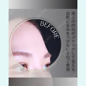 小倉美容外科/美容皮膚科 ビラビューティークリニック 大村 亞蘭医師の症例