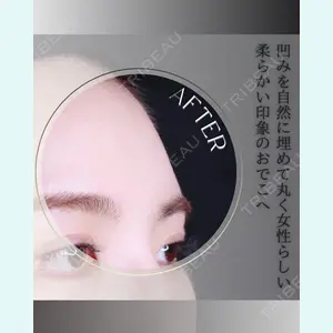 小倉美容外科/美容皮膚科 ビラビューティークリニック 大村 亞蘭医師の症例