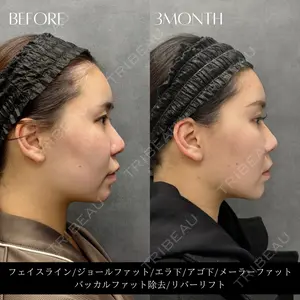 RIVER CLINIC（リバークリニック）大阪院の症例