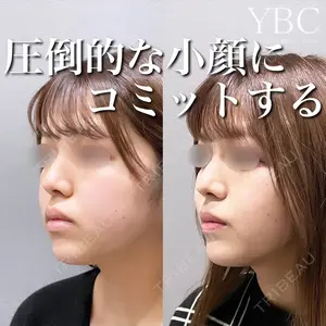 YBC横浜美容外科 大宮院 磯村 亮輔医師の症例