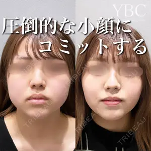 YBC横浜美容外科 大宮院 磯村 亮輔医師の症例