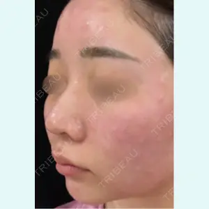 アメリクリニック福岡の症例