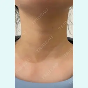 アメリクリニック福岡の症例