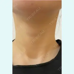 アメリクリニック福岡の症例