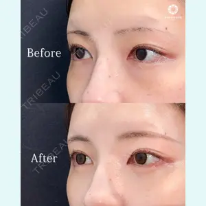 東京形成美容外科 池袋院 弓削田　浩主医師の症例