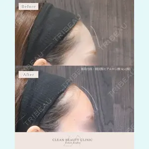 CLEAN BEAUTY CLINIC TokyoAzabu 三田 亜耶医師の症例