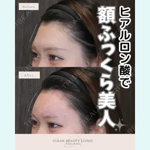 CLEAN BEAUTY CLINIC TokyoAzabu 三田 亜耶医師の症例