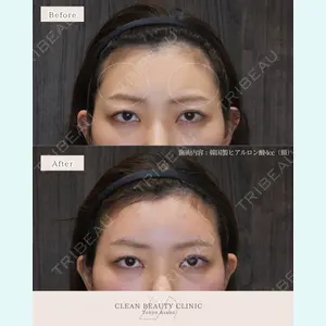 CLEAN BEAUTY CLINIC TokyoAzabu 三田 亜耶医師の症例