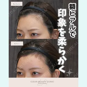 CLEAN BEAUTY CLINIC TokyoAzabu 三田 亜耶医師の症例