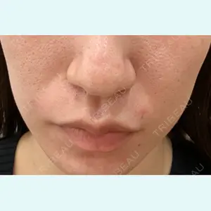 アメリクリニック福岡の症例