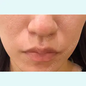 アメリクリニック福岡の症例