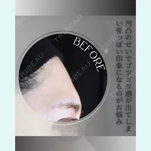 小倉美容外科/美容皮膚科 ビラビューティークリニック 大村 亞蘭医師の症例